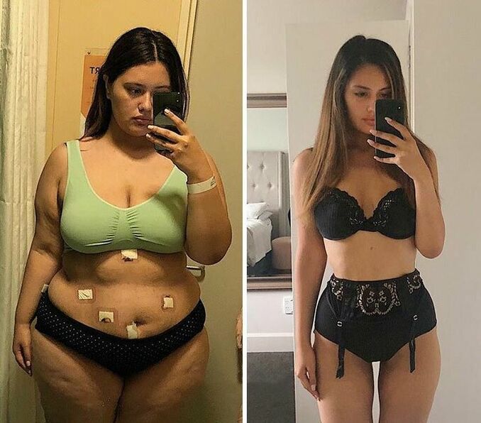 Девушка до и после похудения с капсулами KETO Complete